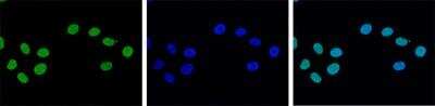 Immunocytochemistry/ Immunofluorescence: Histone H3 [Trimethyl Lys27] Antibody [NBP2-59206]